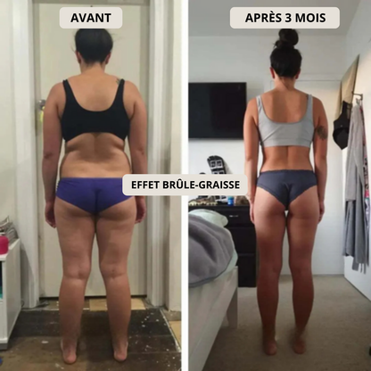3D Anti-Cellulite Leggings