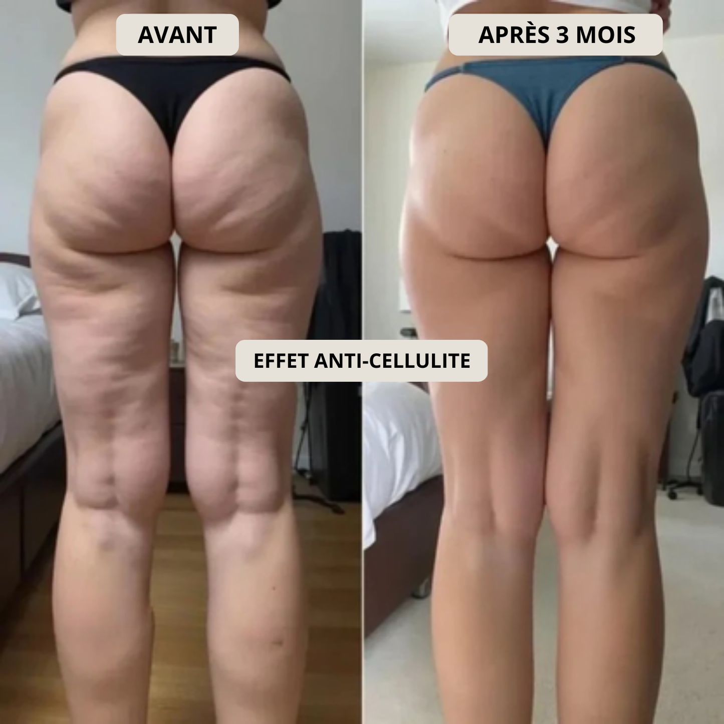 3D Anti-Cellulite Leggings