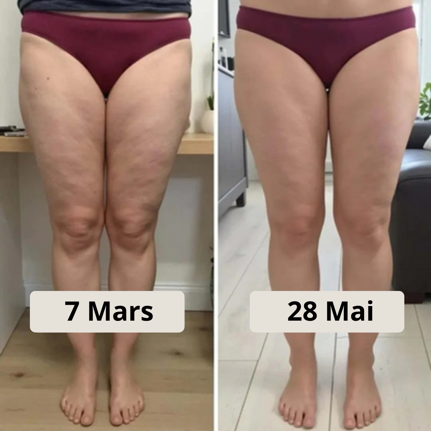 3D Anti-Cellulite Leggings